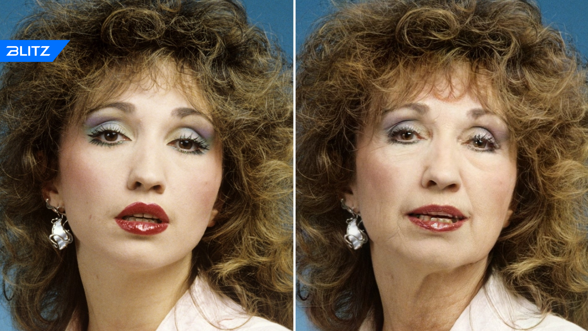 Аллегрова пластика лица до и после фото